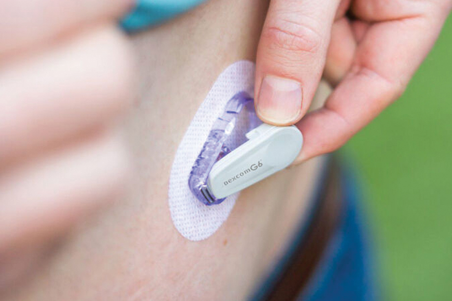 How Long Does a Dexcom G6 Transmitter Last