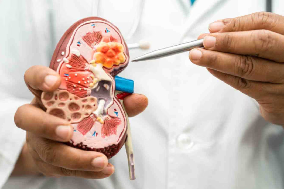 Kidney Disease and its Causes