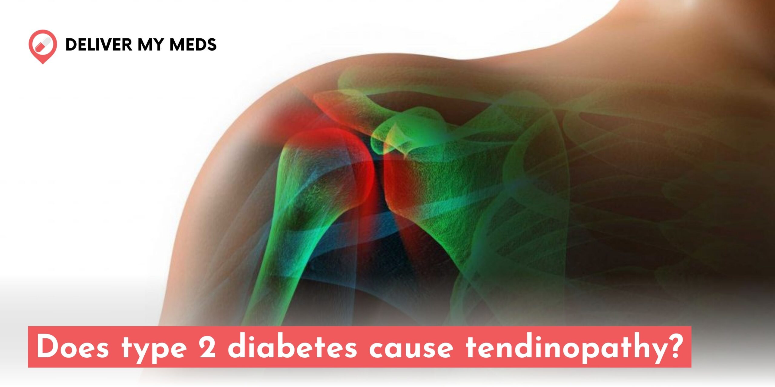 Does type 2 diabetes cause tendinopathy