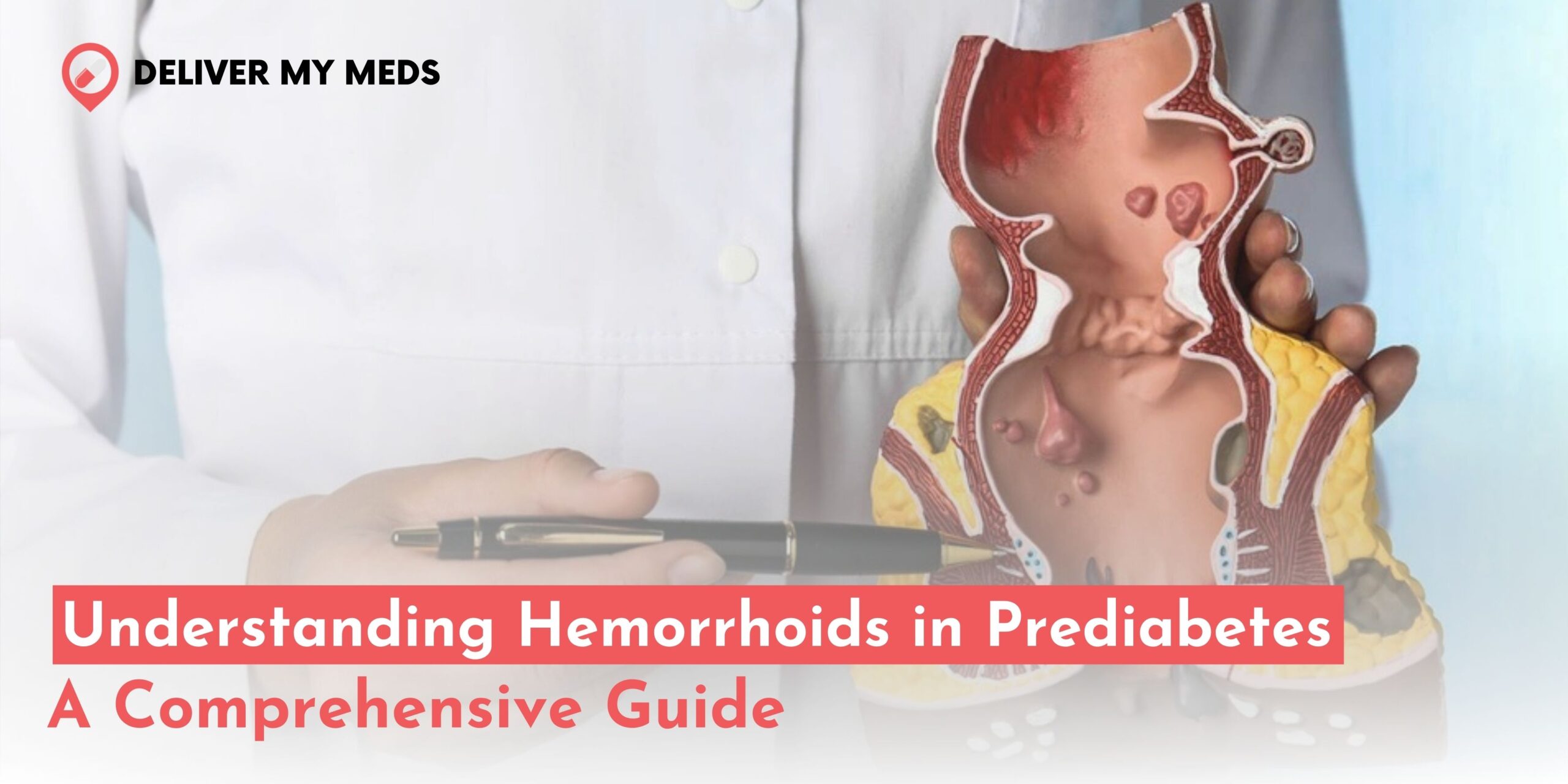 Hemorrhoids in Prediabetes