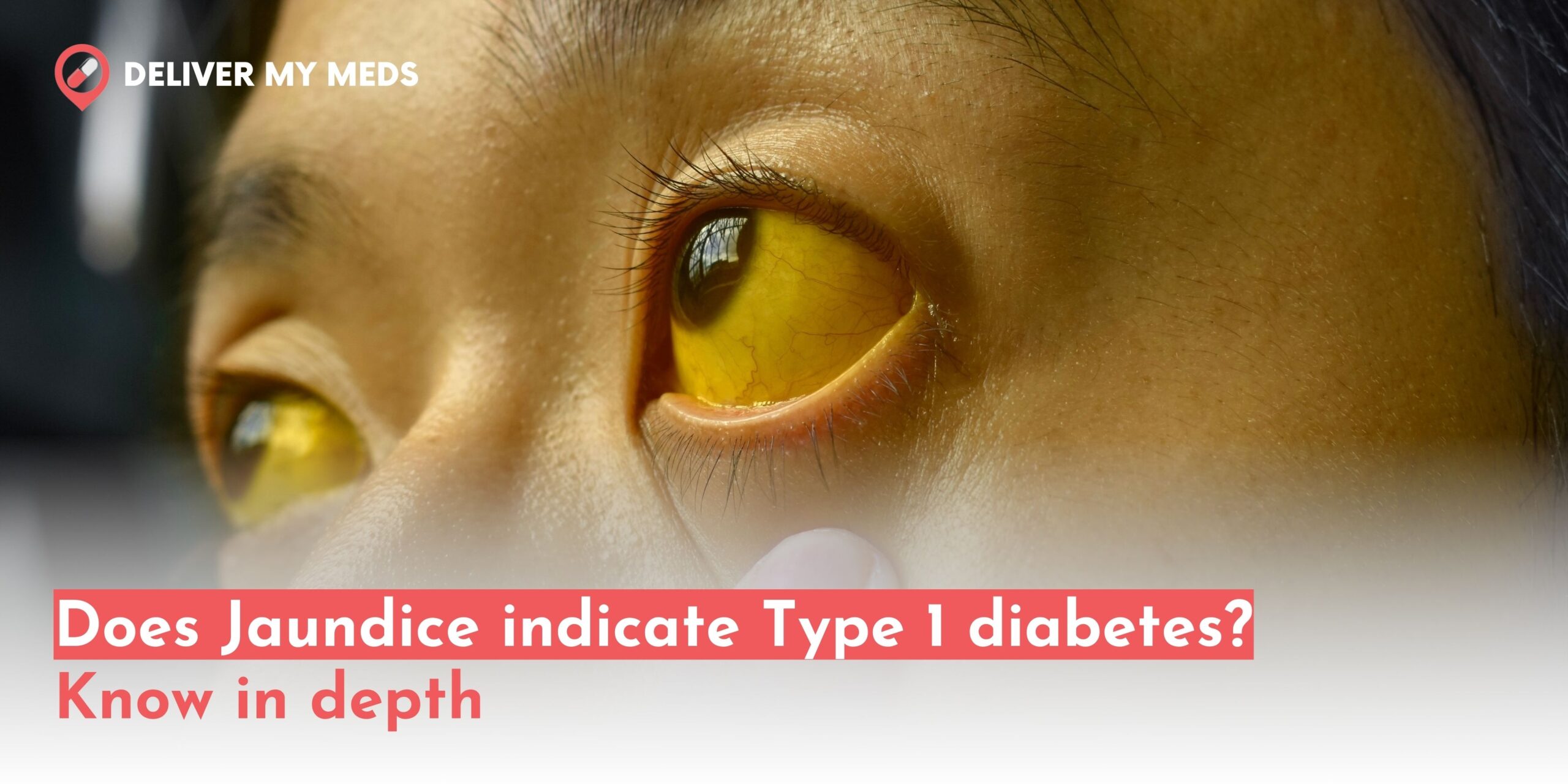 Jaundice indicate Type 1 diabetes