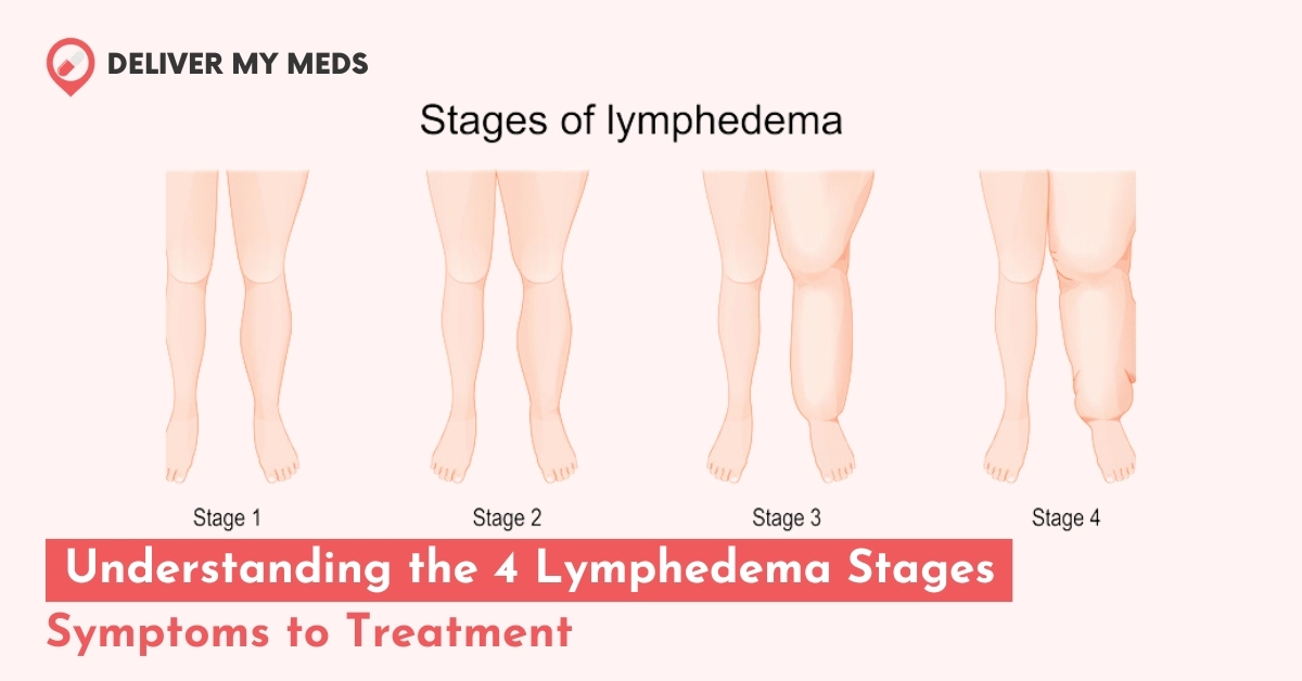 Lymphedema Stages